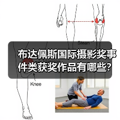 布达佩斯国际摄影奖事件类获奖作品有哪些？（图3）